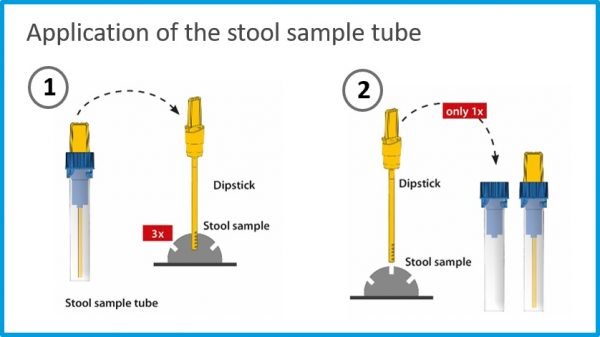 A diagram outlining the process of collecting stool samples with the IDKExtract® Stool Preparation System.