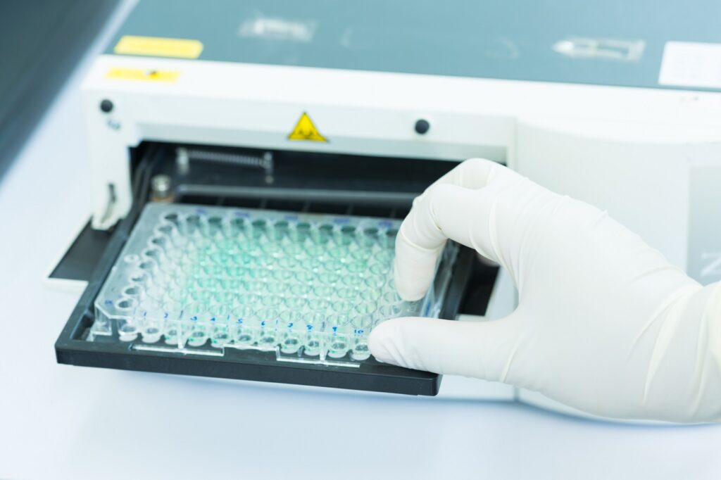 Our partners at Immundiagnostik AG welcome opportunities to collaborate with labs worldwide. 