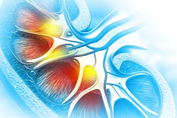 A closeup of an illustration of a human kidney with hotspots indicating kidney injury.
