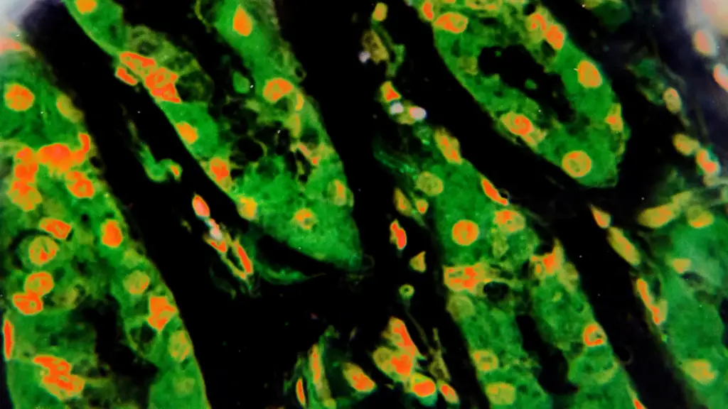Gastric mucosa intestinal metaplasia under microscopy and stained green, orange, and yellow.