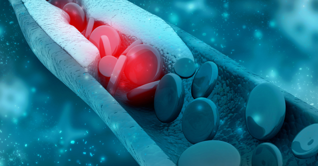 Blood cells moving through a blood vessel with plaque buildup.