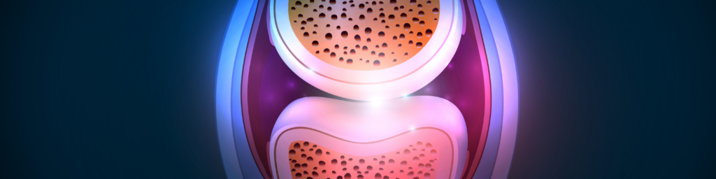A computer-generated image showing a close-up of inflammation in a knee joint with synovial fluid highlighted.